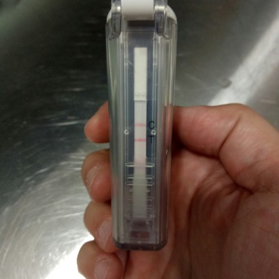 בדיקת PCR יחודית לארליכיה